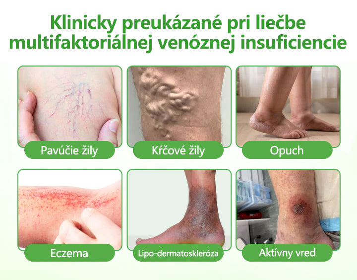 🔥🔥🔥Laleia® VeinHeal náplasť s mikroihličkami