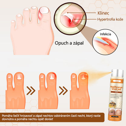 ⭐Laleia® NailRescue sprej s včelím jedom