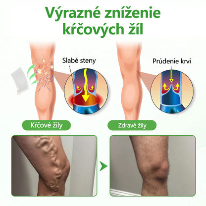 🔥🔥🔥Laleia® VeinHeal náplasť s mikroihličkami