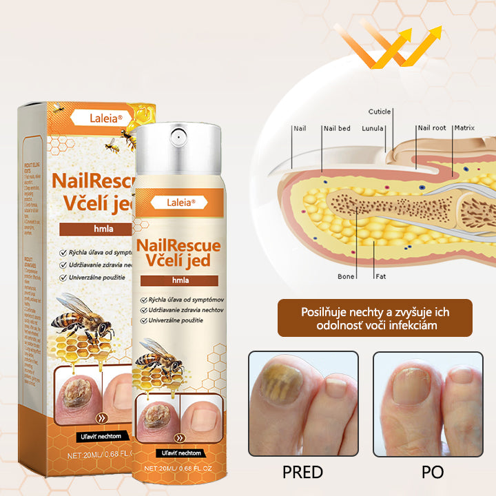 ⭐Laleia® NailRescue sprej s včelím jedom