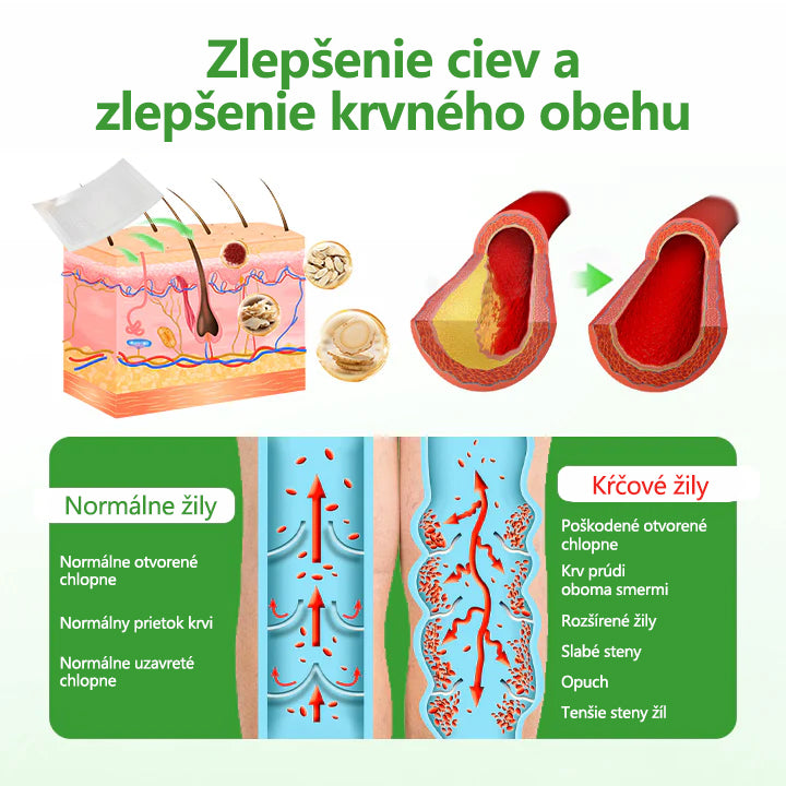 🔥🔥🔥Laleia® VeinHeal náplasť s mikroihličkami