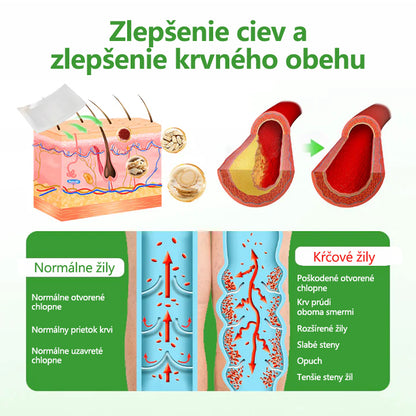 🔥🔥🔥Laleia® VeinHeal náplasť s mikroihličkami