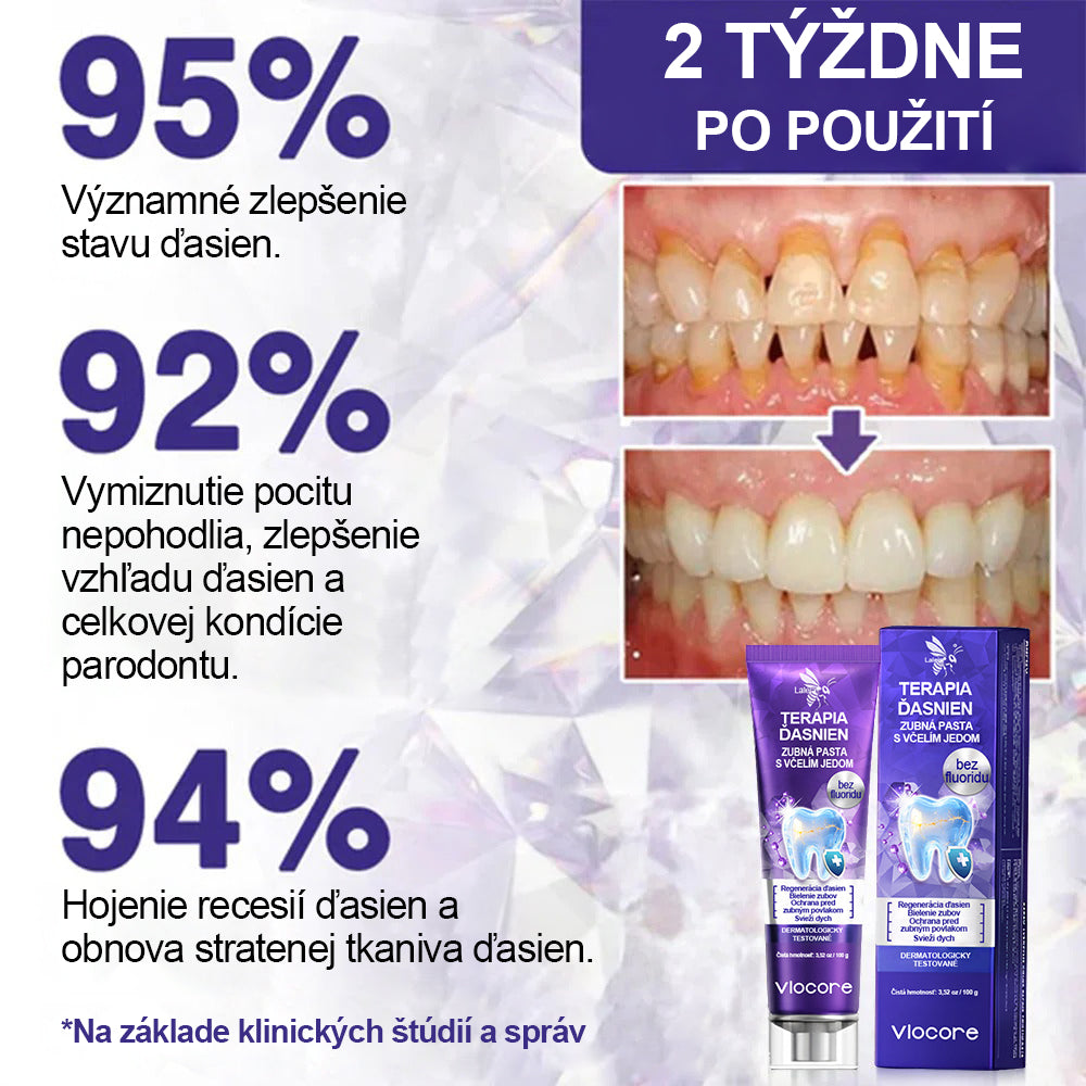 🔥🔥Laleia® VioCore Zubná pasta s včelím jedom na ošetrenie zubov