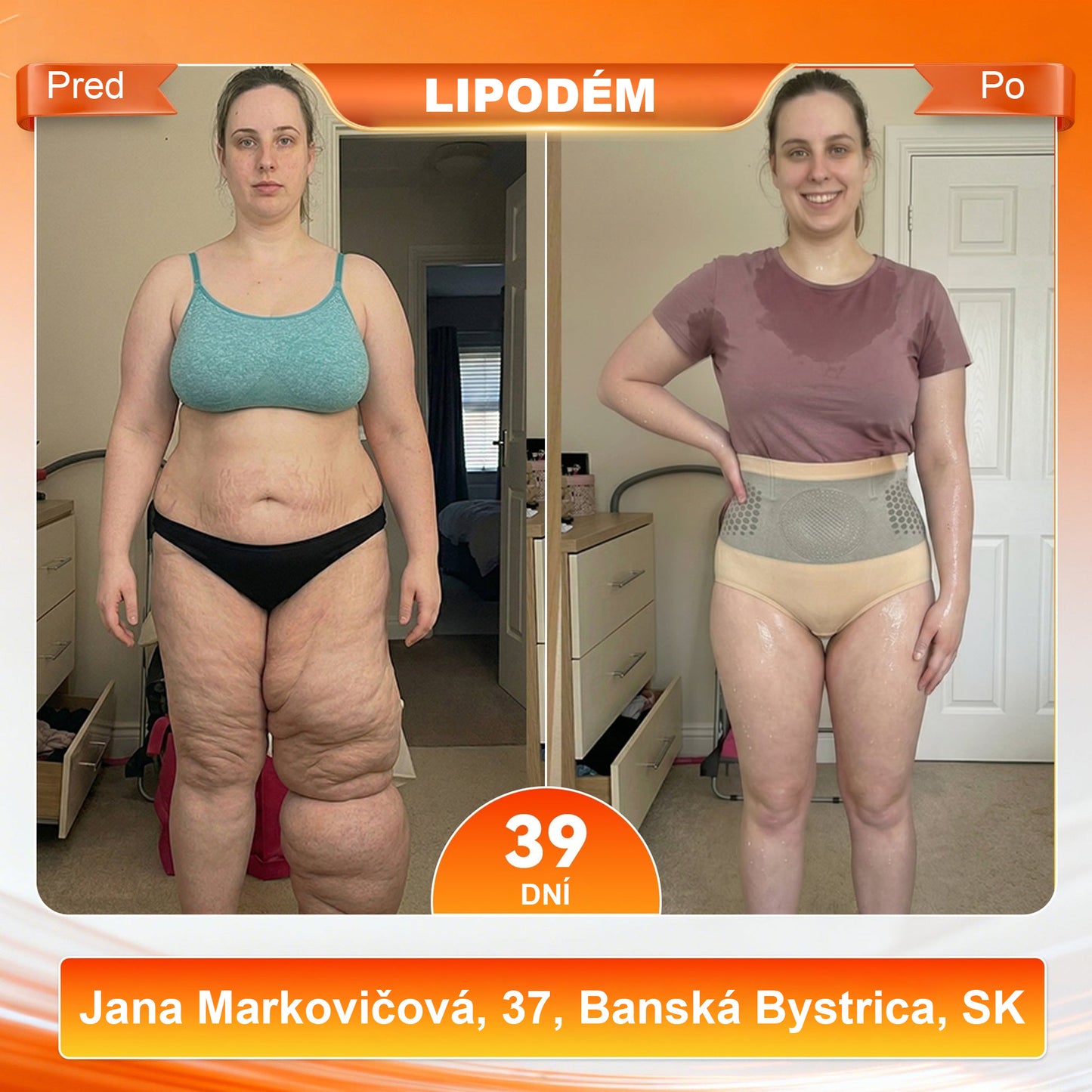 Laleia® 2026 Moringa a Berberín 4 v 1 Mikročasticové tvarovacie a spaľovače tuku šortky🛡️🛡️